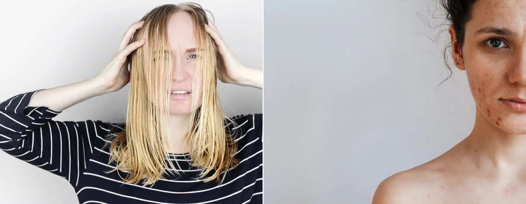 fettige Haare